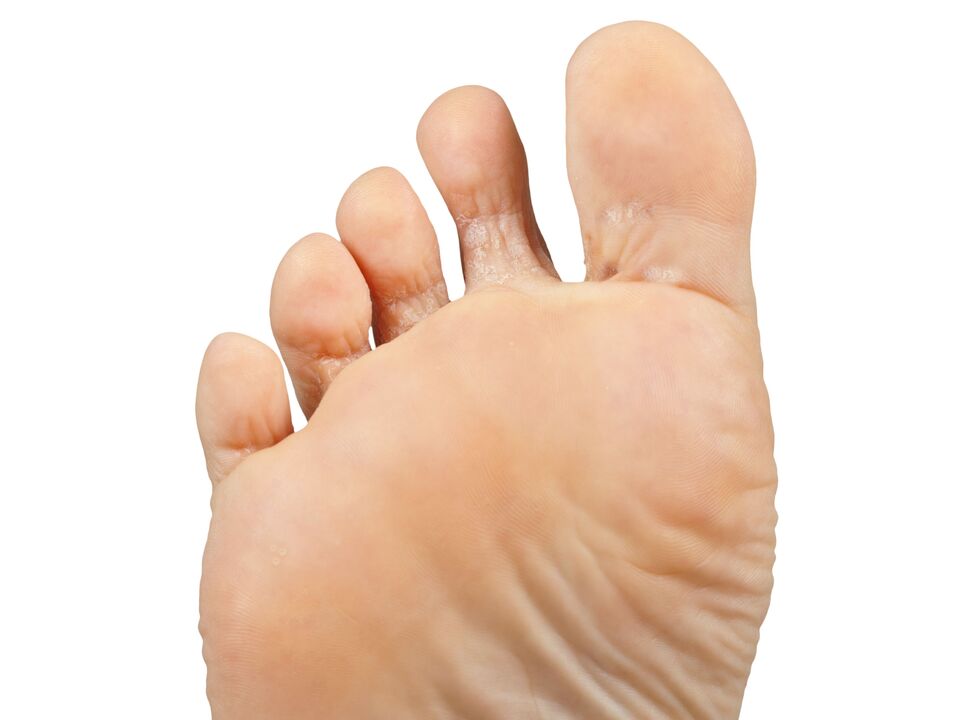 Funder-Good and Par-and-Hektyczny-Cream-Demyxil