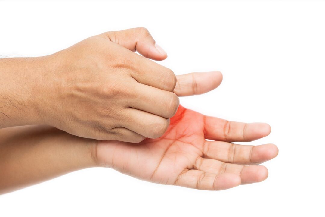 Swędzenie z grzybem i leczeniem kremem demiksilowym